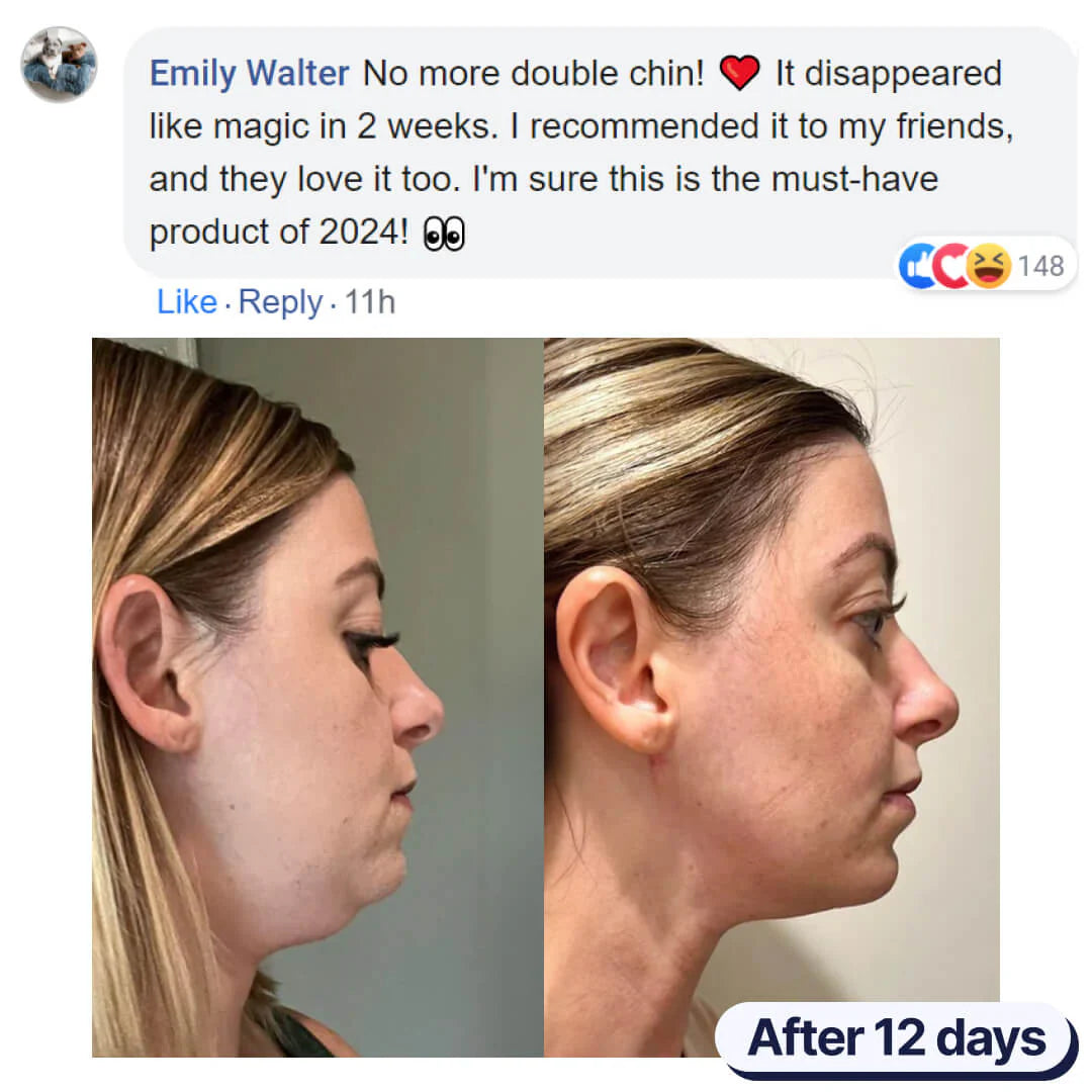 v line lifting mask
